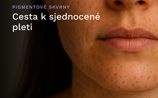 Cesta k sjednocené pleti: Jak vyzrát na pigmentové skvrny
