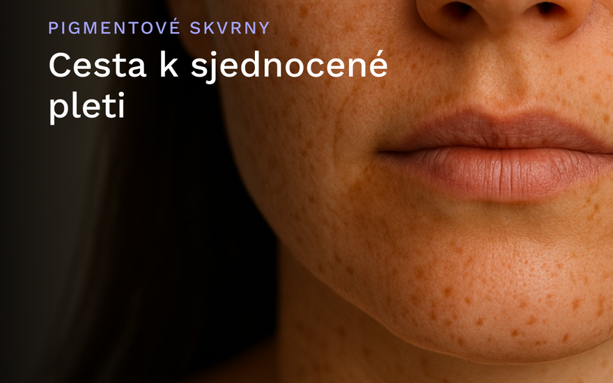 Cesta k sjednocené pleti: Jak vyzrát na pigmentové skvrny